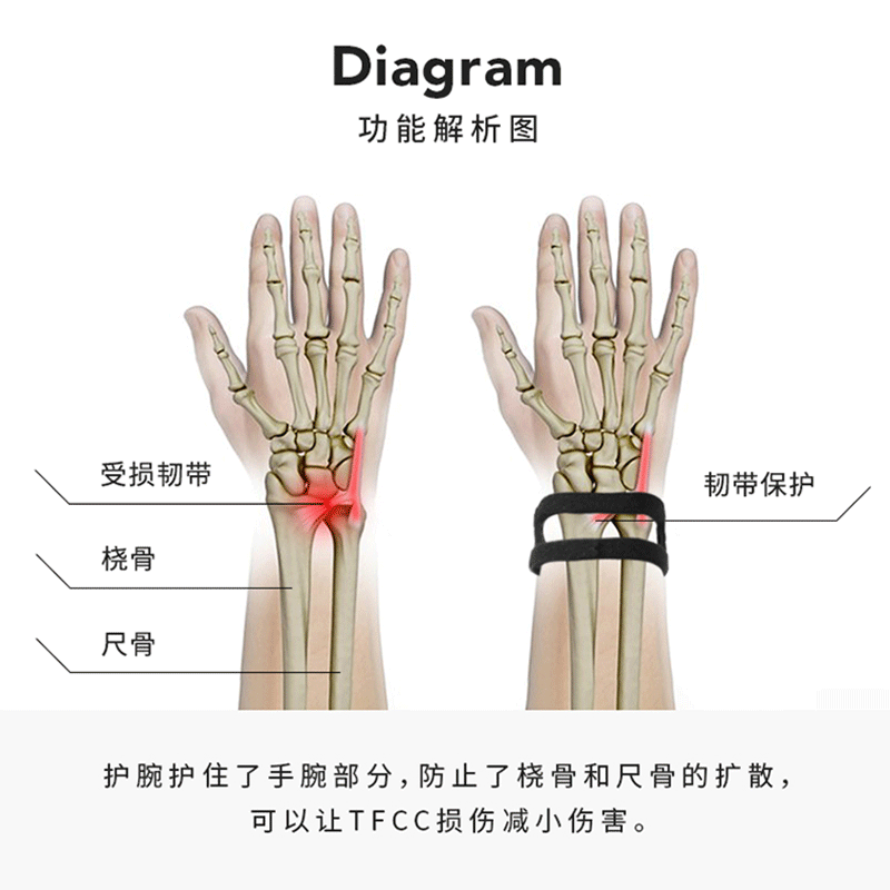 MOKO MAX Italian TFCC Wrist Brace, Sports Fitness Tendonitis Wrist Support, Anti...