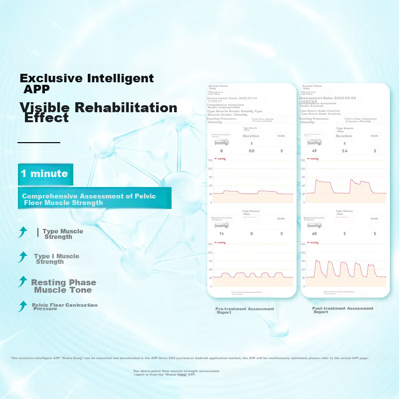 Mamaka Kang [Qixi] Pelvic Floor Muscle Rehabilitation Device, Pelvic Floor Muscl...